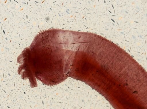 Taenia taeniaeformis