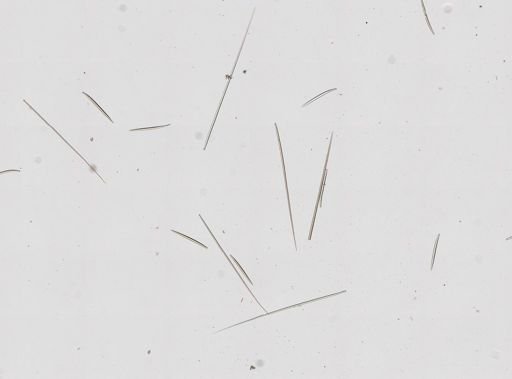 Tentorium semisuberites