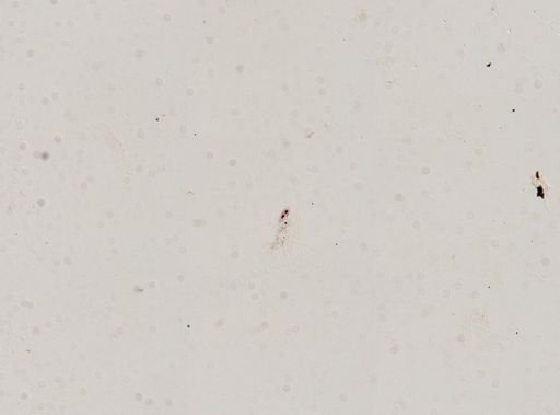 Stylonychia mytilus
