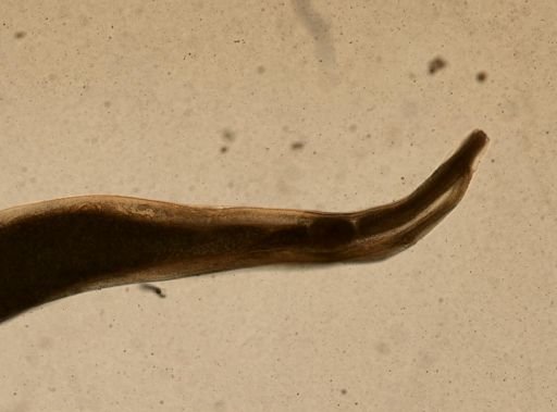 Enterobius vermicularis
