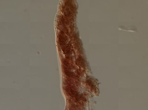 Nephtheidae?