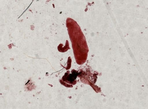 Fasciola hepatica