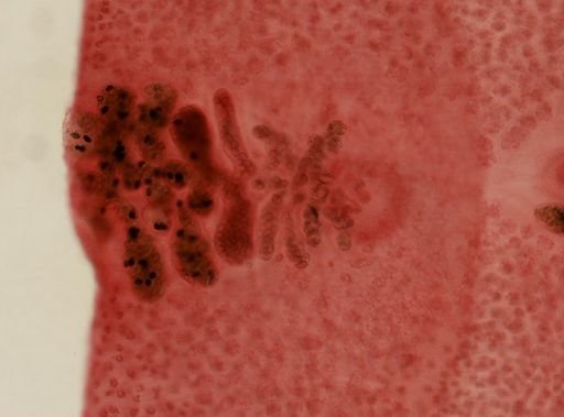 Diphyllobothrium latum