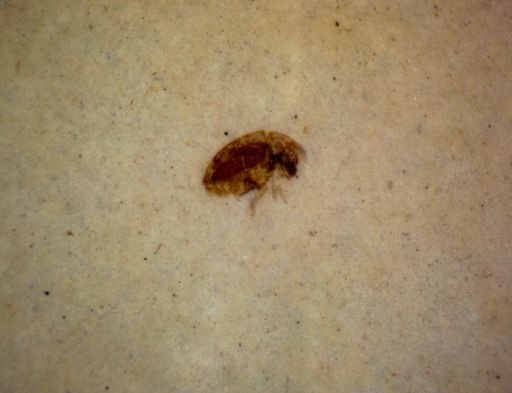 undet. Coleoptera