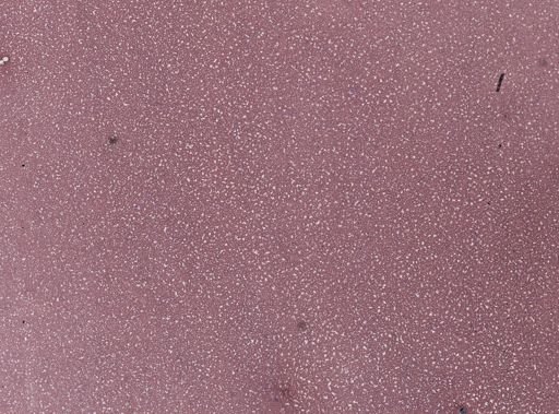 Trypanosoma lewisi