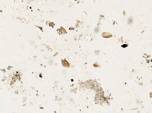 Paragonimus westermani