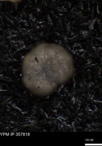 undet. Foraminiferida