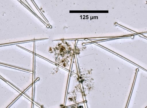 Cliona aprica