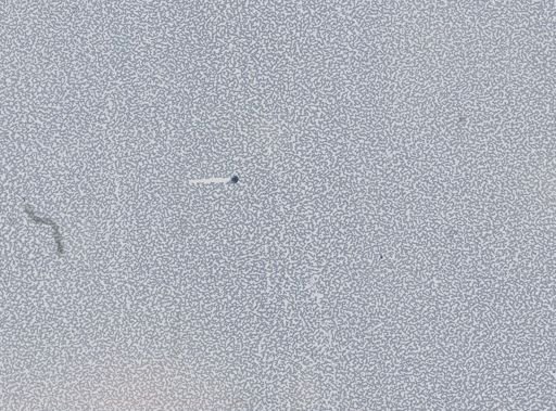 Plasmodium vivax