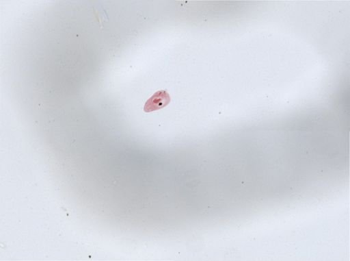 Paramecium aurelia