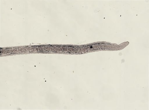 Turbellaria