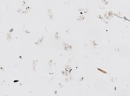 Paramecium aurelia