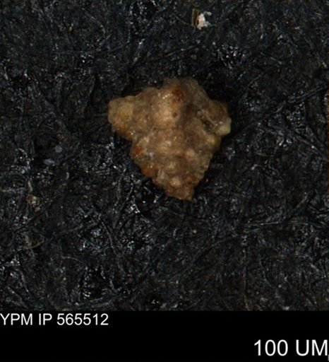 Verneuilina canadensis