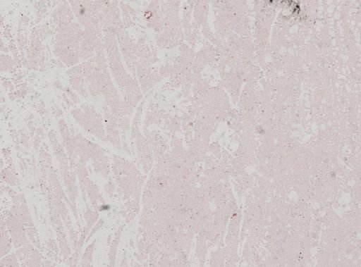 Trypanosoma brucei