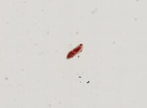 Trematoda