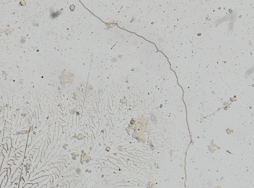 Taenia solium