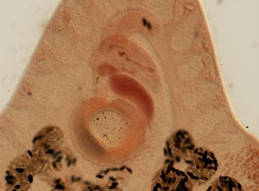Fasciola hepatica