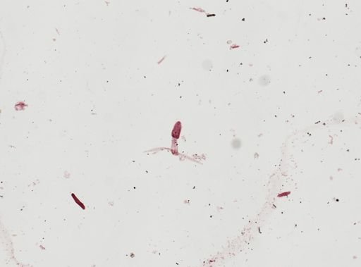 Cercaria gracillima
