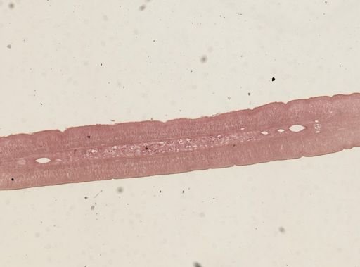 Taenia taeniaeformis