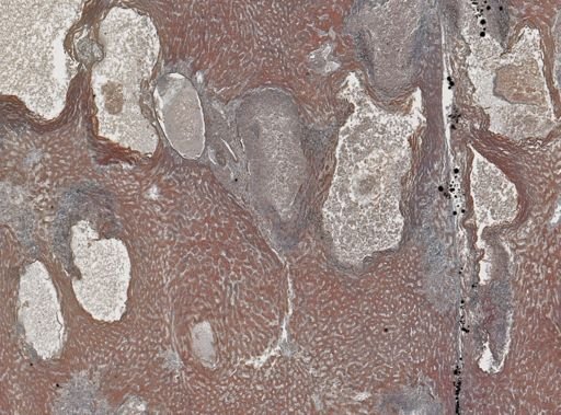 Taenia crassicollis