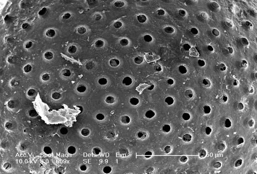 Sphaeroidinella dehiscens