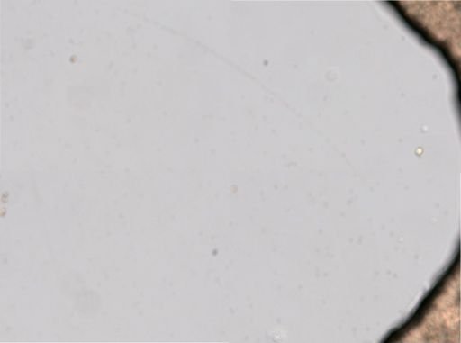 Ploesoma lenticulare
