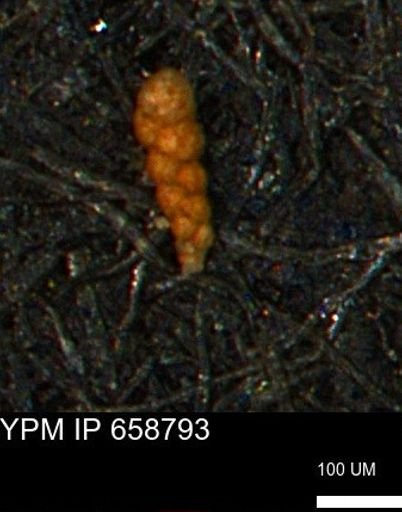 Verneuilinoides kansasensis