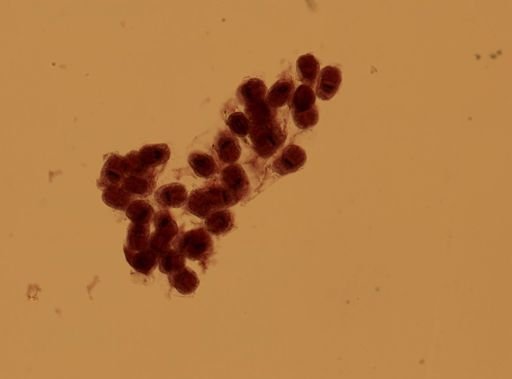 Echinococcus granulosus