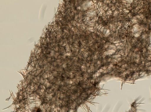 Haliclona (Gellius)