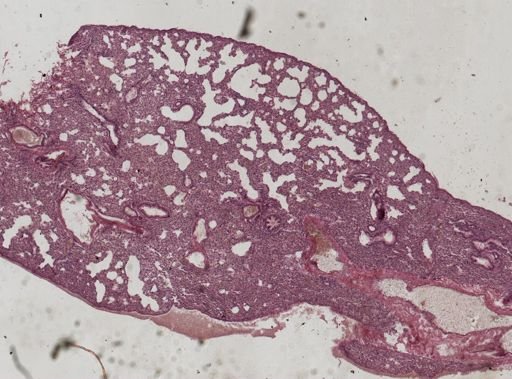 Leishmania donovani