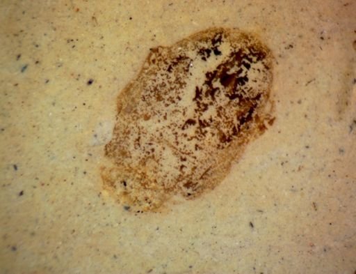 undet. Coleoptera