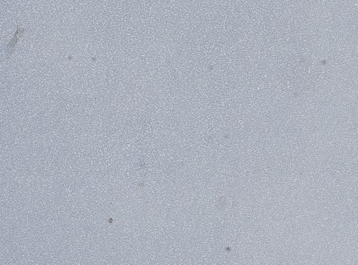 Plasmodium vivax