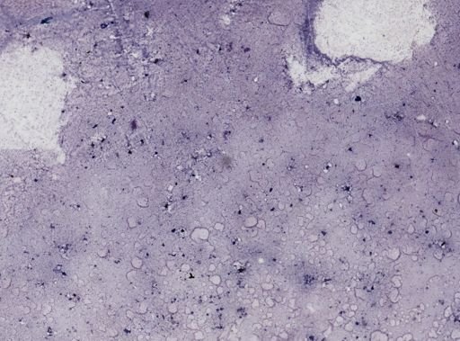 Leishmania donovani