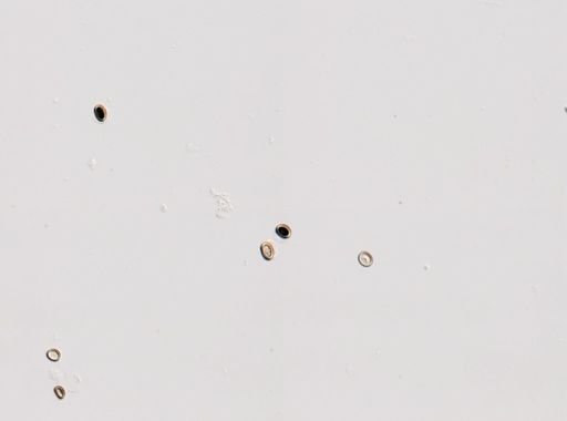 Cestoda