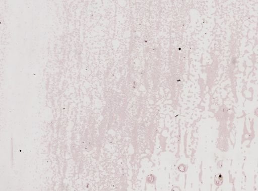 Plasmodium vivax