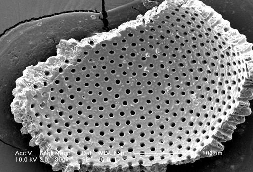 Globigerinoides sacculifer