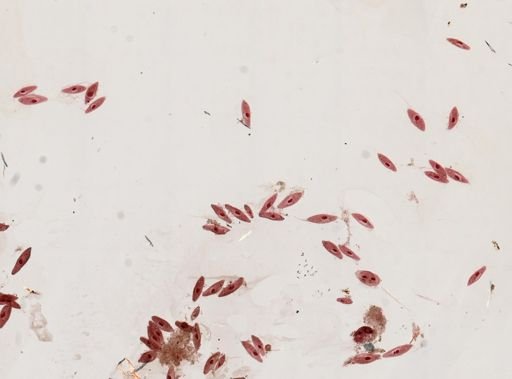 Paramecium