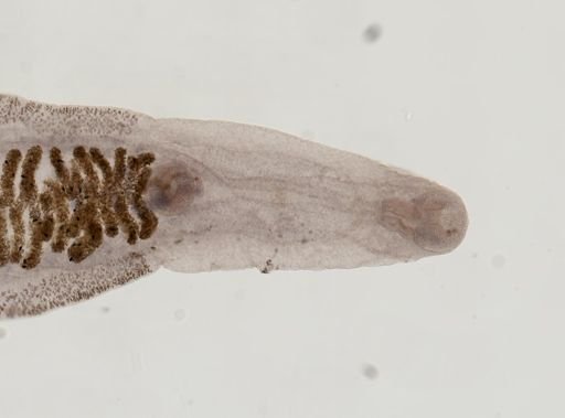 Clonorchis sinensis