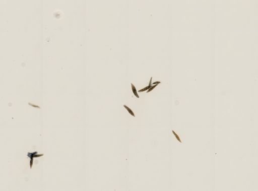 Paramecium