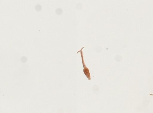Schistosoma mansoni