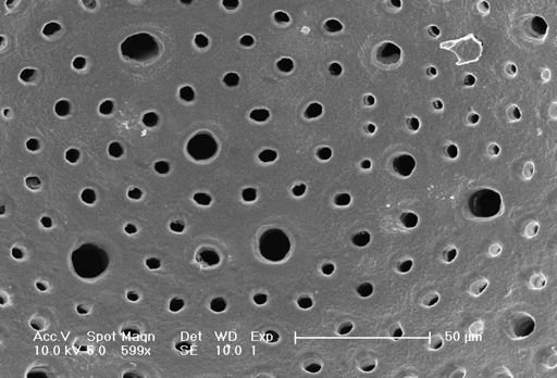 Neogloboquadrina dutertrei
