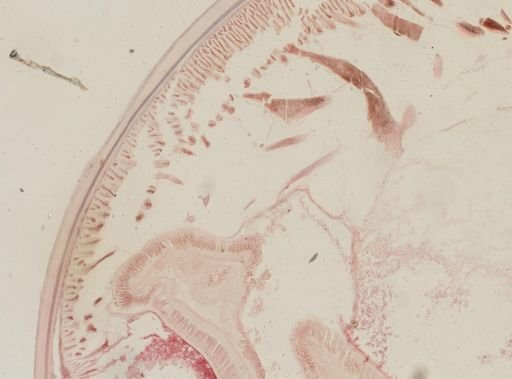 Ascaris megalocephala