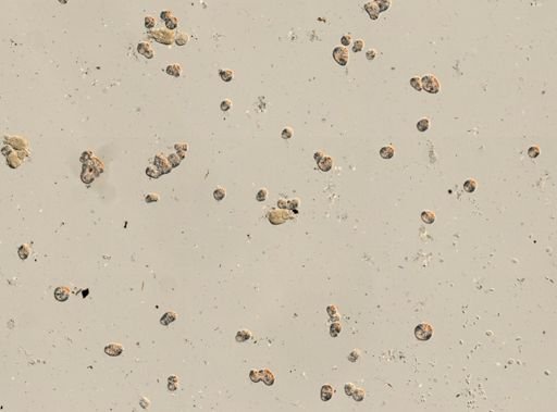 Brachionus angularis