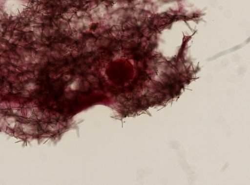 Antho lithophoenix