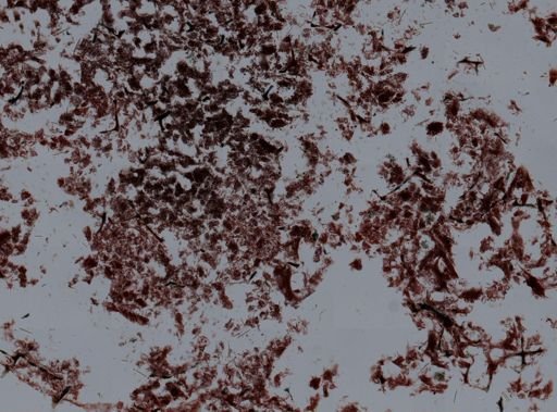 Actiniaria
