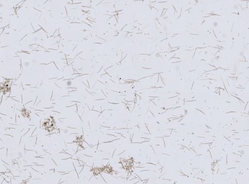 Haliclonidae