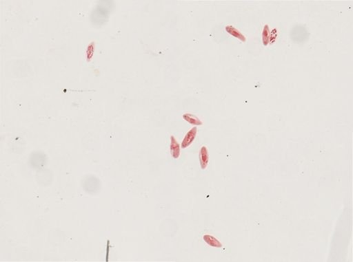 Paramecium calkinsi