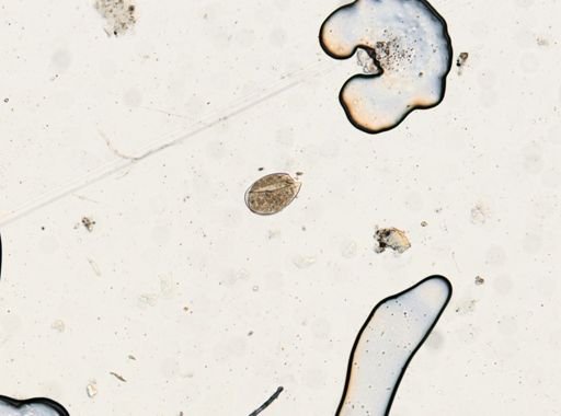 Fasciolopsis buski