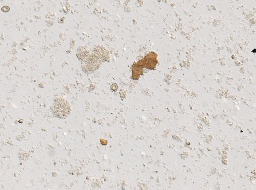 Diphyllobothrium latum