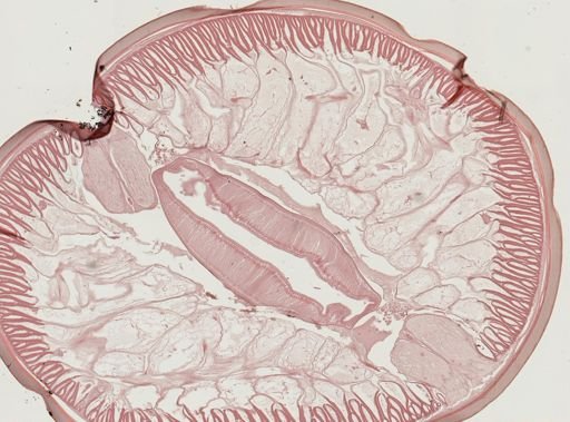Ascaris lumbricoides